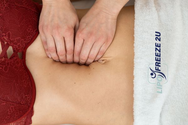 diastasis recti treatment Dorchester
