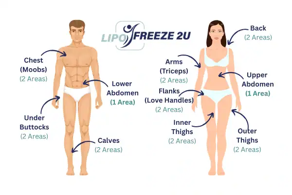 Areas you can have fat freezing treatment Dorchester