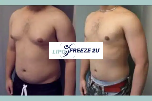 How Long Does It Take to See Results Dorchester?