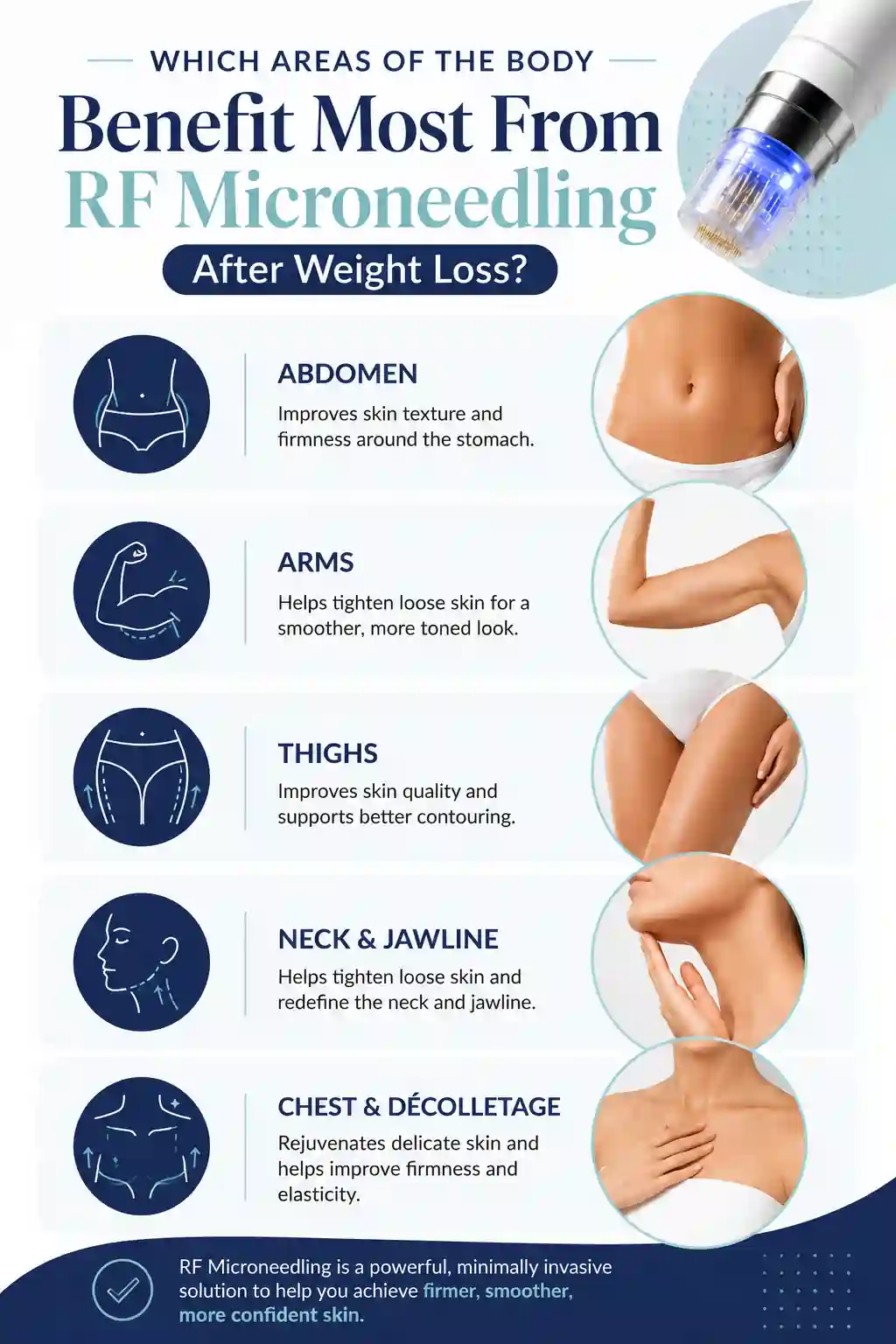 Which Areas of the Body Benefit Most From RF Microneedling After Weight Loss Dorchester
